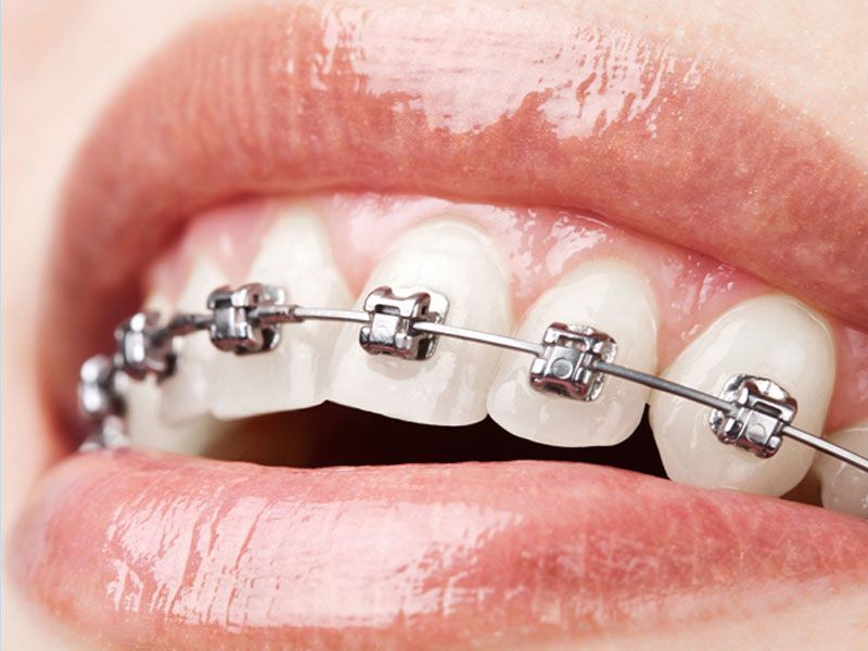 Orthodontics